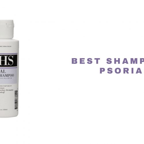 top shampoo for psoriasis