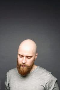 bald head 