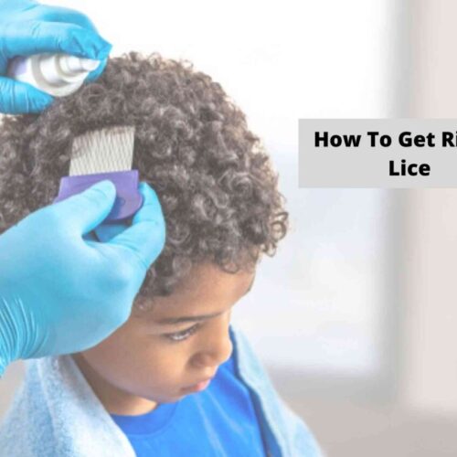 how to get rid of head lice