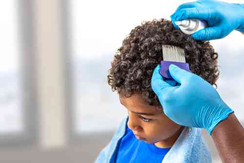 how to get rid of head lice with salt