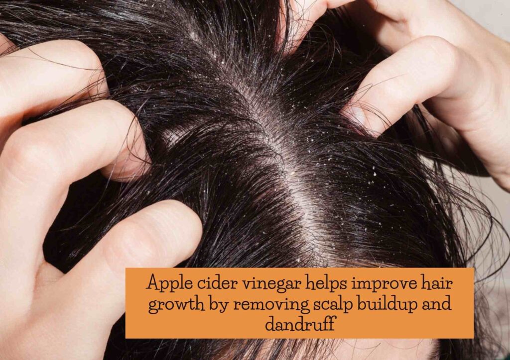 does apple cider vinegar help with hair growth