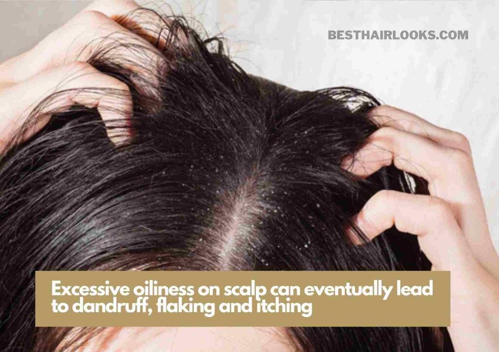 signs of oily scalp