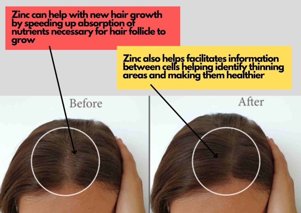 Zinc for hair growth reviews